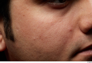 HD Face Skin Raymon Kastor cheek face skin pores skin…